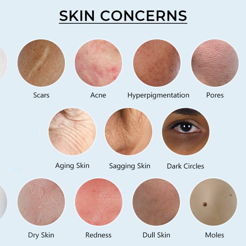 Skin Care Consultation